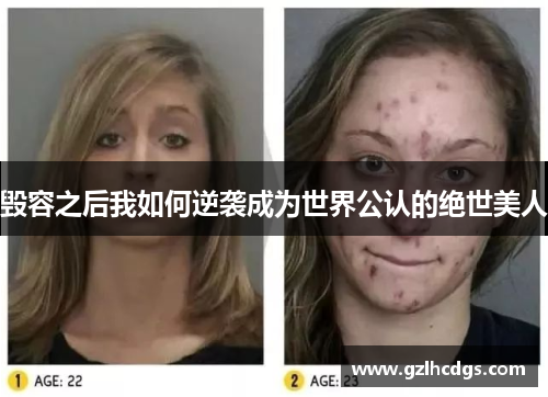 毁容之后我如何逆袭成为世界公认的绝世美人